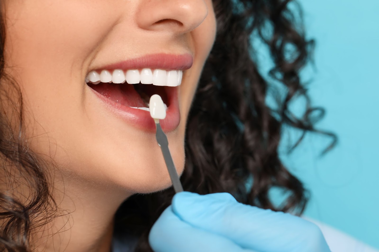 Jeune femme aux cheveux foncés se faisant poser une couronne dentaire. Elle n'en a pas de besoin, elle a de très belle dents. 